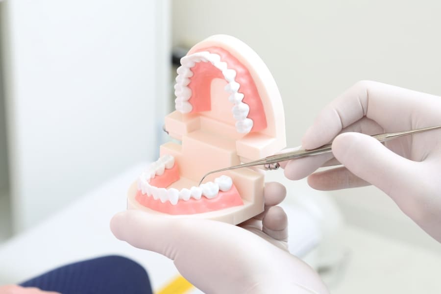 歯周病のセルフチェック